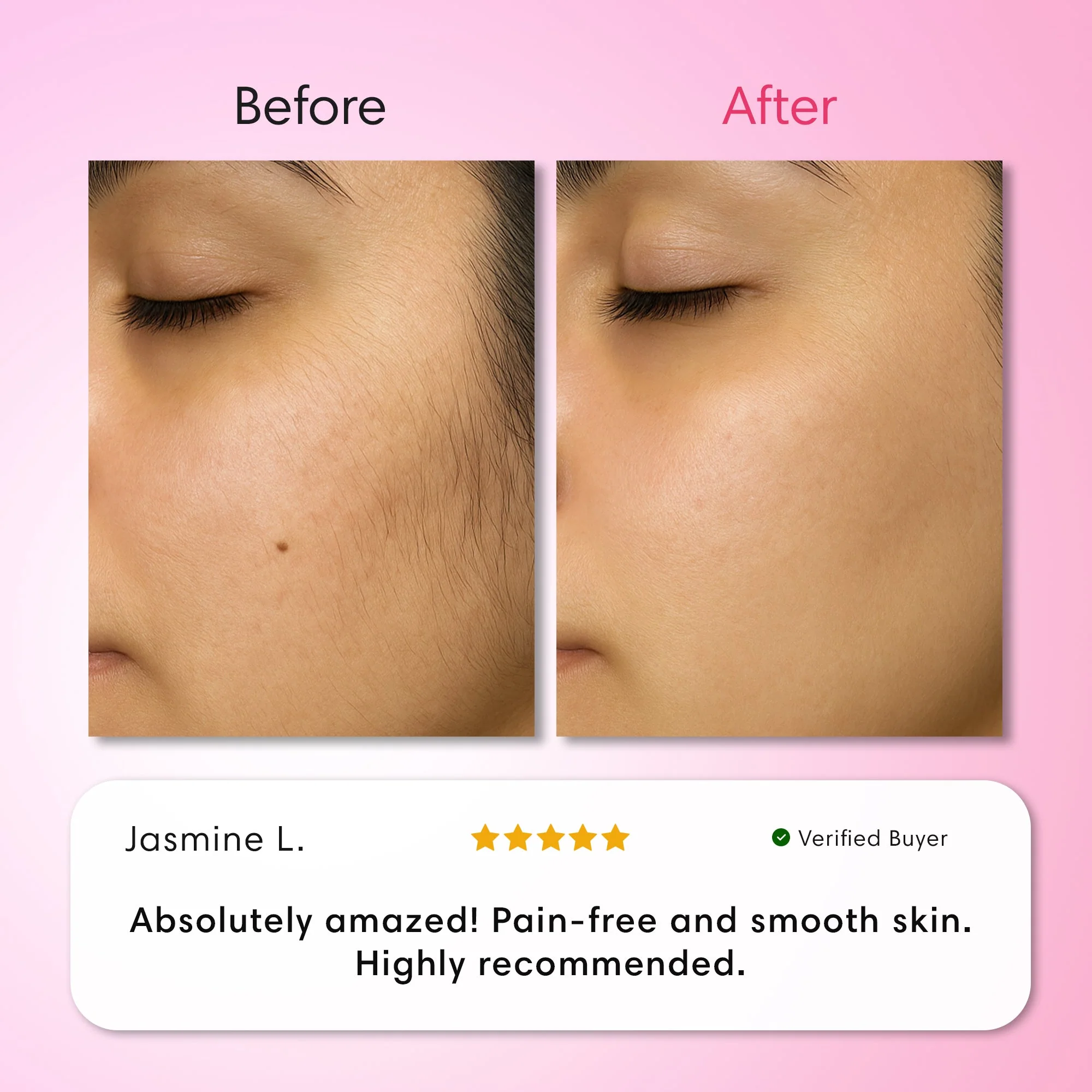 Hair Removal Trilogy Kit - Image 6