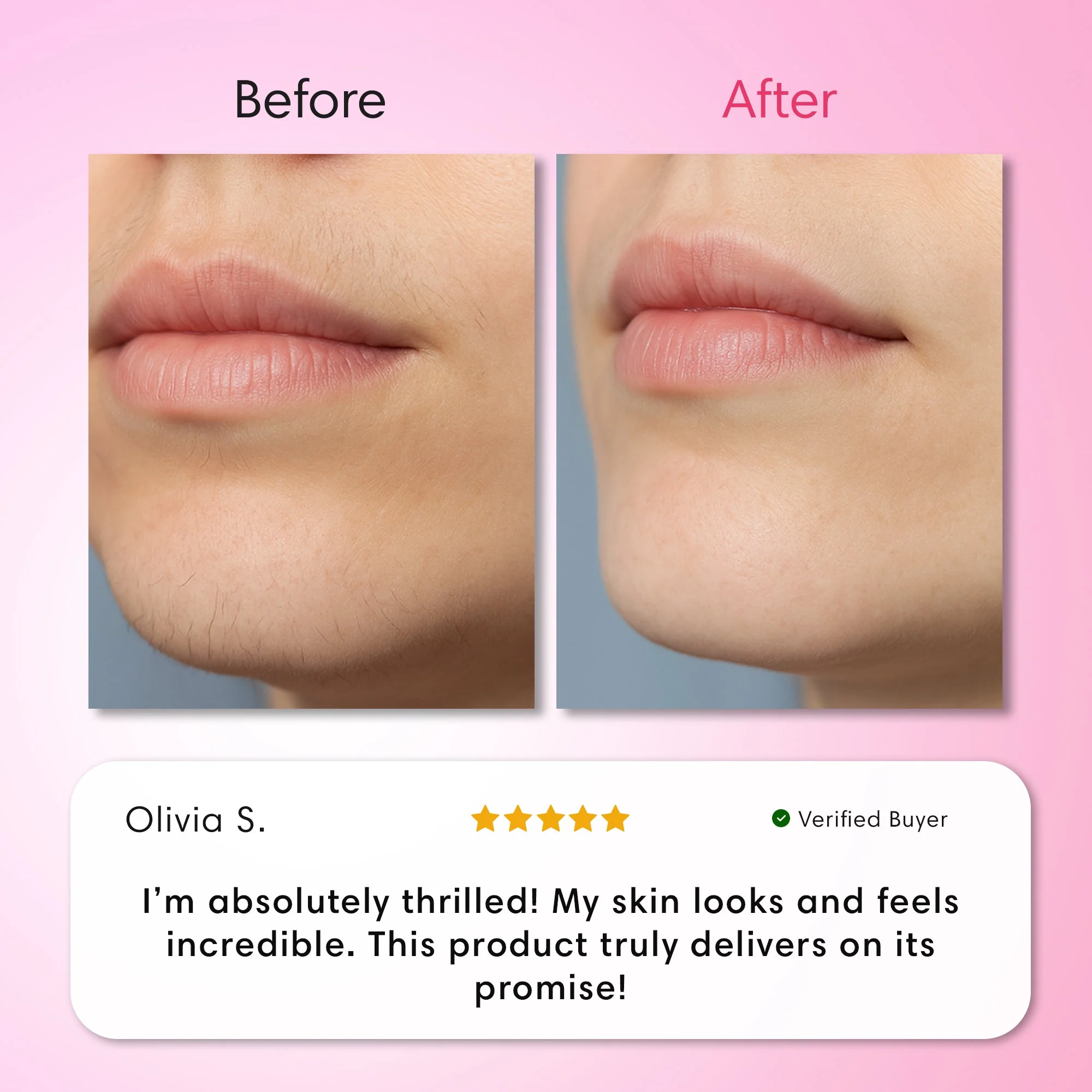 Hair Removal Trilogy Kit - Image 9