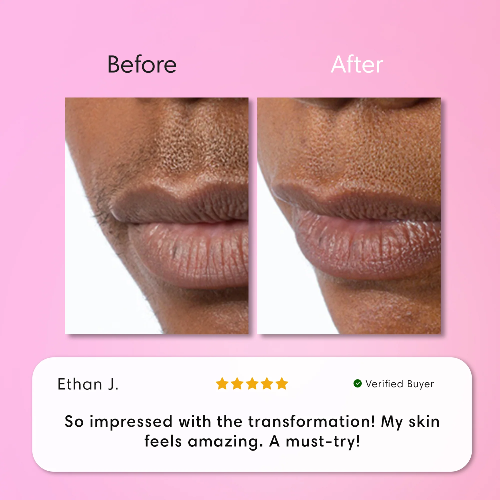 Instant Hair Removal Kit - Image 10