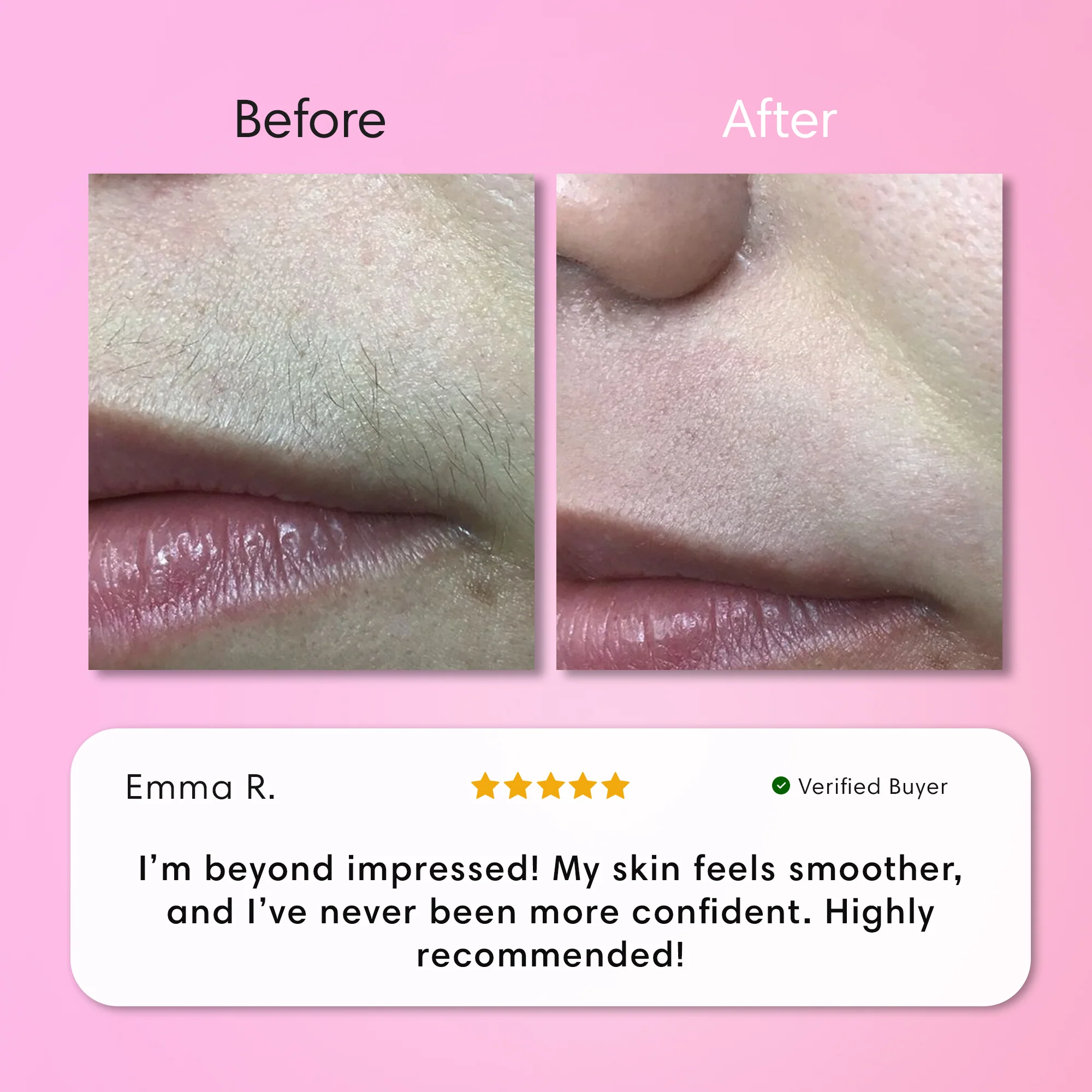 Instant Hair Removal Kit - Image 11