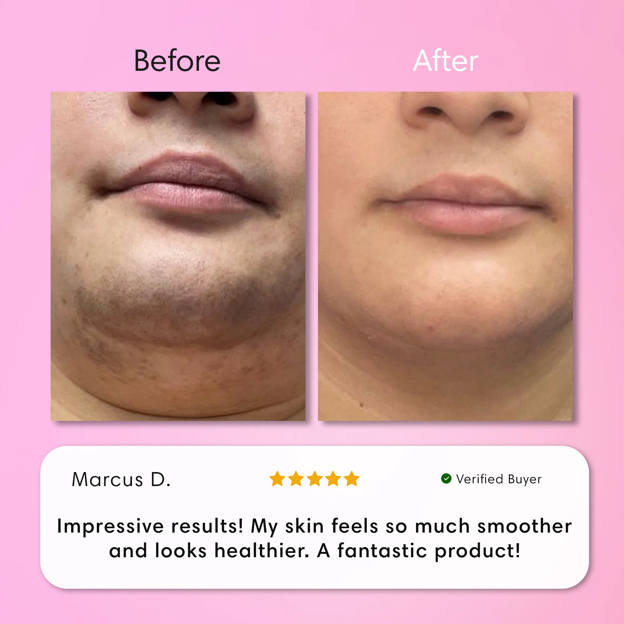 Instant Hair Removal Kit - Image 4