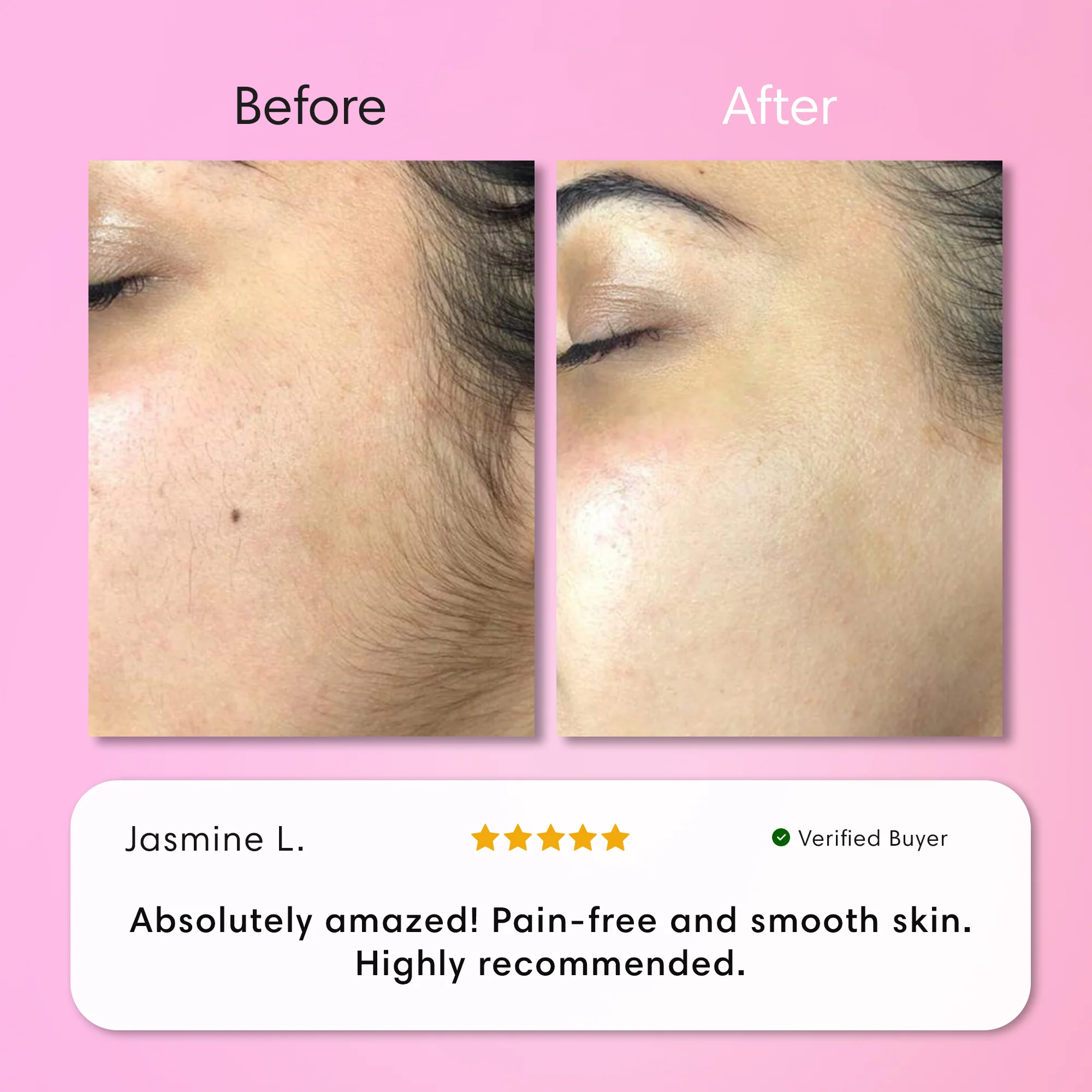 Instant Hair Removal Kit - Image 6