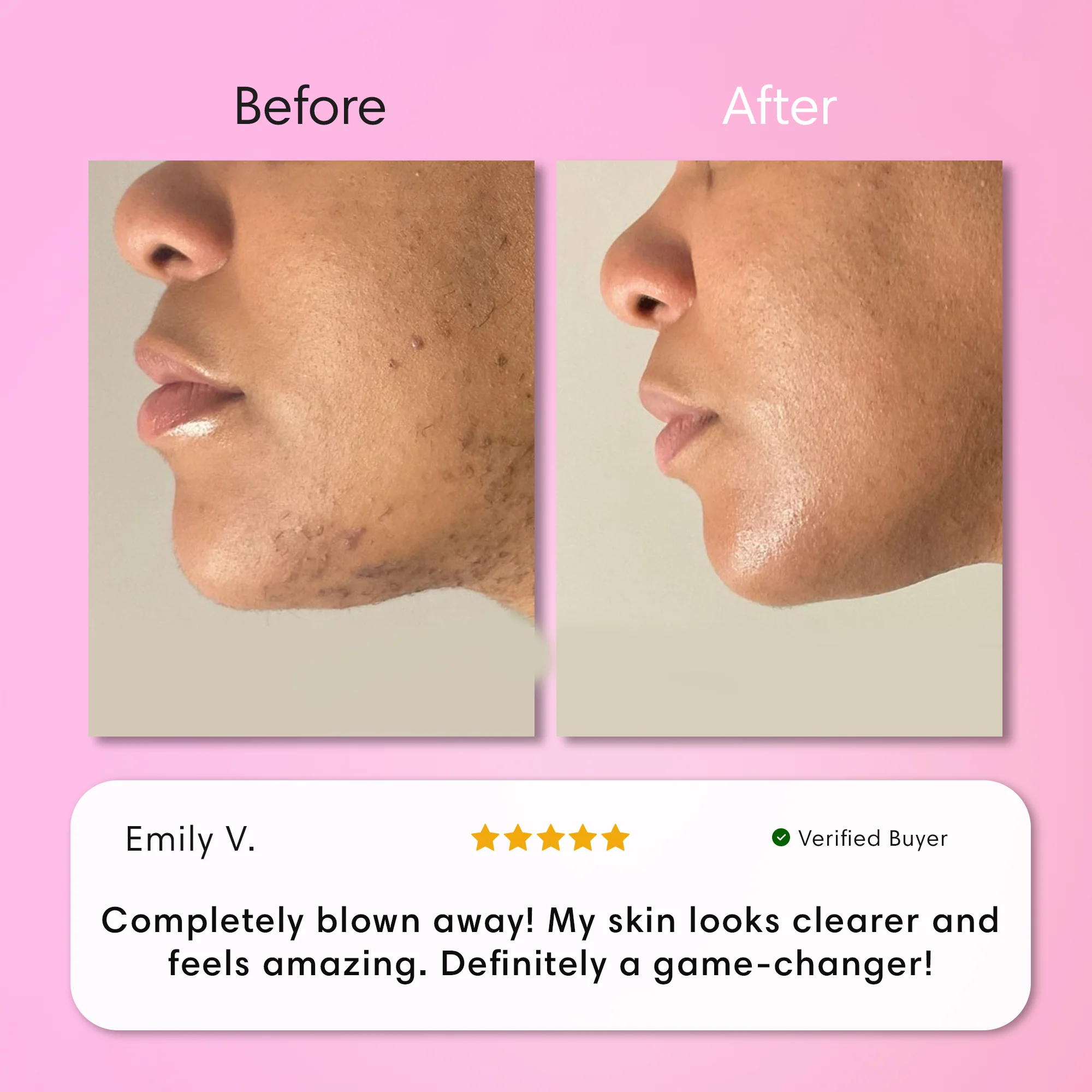 Instant Hair Removal Kit - Image 8